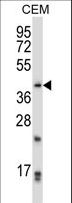 PITX2 / RGS Antibody - PITX2 Antibody western blot of CEM cell line lysates (35 ug/lane). The PITX2 antibody detected the PITX2 protein (arrow).