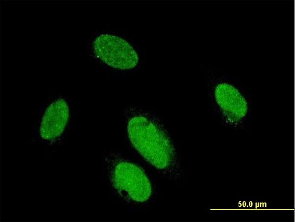 PITX2 / RGS Antibody - Immunofluorescence of monoclonal antibody to PITX2 on HeLa cell . [antibody concentration 10 ug/ml]