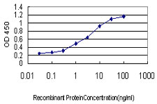 PITX2 / RGS Antibody - Detection limit for recombinant GST tagged PITX2 is approximately 0.03 ng/ml as a capture antibody.