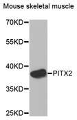 PITX2 / RGS Antibody - Western blot analysis of extracts of Mouse skeletal muscle cells.