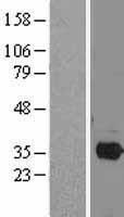 PITX2 / RGS Protein - Western validation with an anti-DDK antibody * L: Control HEK293 lysate R: Over-expression lysate