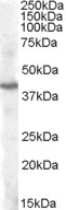 PITX3 Antibody - Antibody (1 ug/ml) staining of Human Cerebellum lysate (35 ug protein in RIPA buffer). Primary incubation was 1 hour. Detected by chemiluminescence.