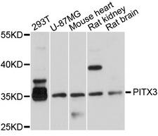 PITX3 Antibody - Western blot analysis of extracts of various cell lines, using PITX3 antibody at 1:1000 dilution. The secondary antibody used was an HRP Goat Anti-Rabbit IgG (H+L) at 1:10000 dilution. Lysates were loaded 25ug per lane and 3% nonfat dry milk in TBST was used for blocking. An ECL Kit was used for detection and the exposure time was 10s.