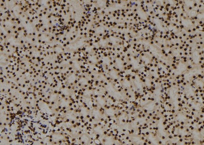 PITX3 Antibody - 1:100 staining mouse kidney tissue by IHC-P. The sample was formaldehyde fixed and a heat mediated antigen retrieval step in citrate buffer was performed. The sample was then blocked and incubated with the antibody for 1.5 hours at 22°C. An HRP conjugated goat anti-rabbit antibody was used as the secondary.