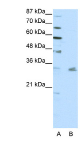 PITX3 Antibody - PITX3 antibody Western blot of HepG2 cell lysate. This image was taken for the unconjugated form of this product. Other forms have not been tested.