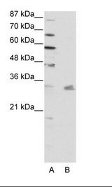 PITX3 Antibody - A: Marker, B: HepG2 Cell Lysate.  This image was taken for the unconjugated form of this product. Other forms have not been tested.