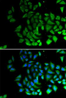 PIWIL1 / PIWI Antibody - Immunofluorescence analysis of U2OS cells.
