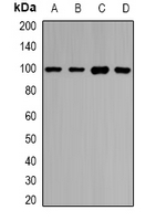 PIWIL1 / PIWI Antibody - Western blot analysis of HIWI1 expression in HepG2 (A); SKOV3 (B); mouse testis (C); rat testis (D) whole cell lysates.