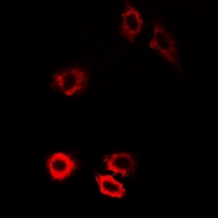 PIWIL1 / PIWI Antibody - Immunofluorescent analysis of HIWI1 staining in U2OS cells. Formalin-fixed cells were permeabilized with 0.1% Triton X-100 in TBS for 5-10 minutes and blocked with 3% BSA-PBS for 30 minutes at room temperature. Cells were probed with the primary antibody in 3% BSA-PBS and incubated overnight at 4 deg C in a humidified chamber. Cells were washed with PBST and incubated with a DyLight 594-conjugated secondary antibody (red) in PBS at room temperature in the dark.