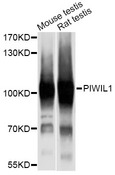 PIWIL1 / PIWI Antibody - Western blot analysis of extracts of various cell lines, using PIWIL1 antibody at 1:1000 dilution. The secondary antibody used was an HRP Goat Anti-Rabbit IgG (H+L) at 1:10000 dilution. Lysates were loaded 25ug per lane and 3% nonfat dry milk in TBST was used for blocking. An ECL Kit was used for detection and the exposure time was 3s.