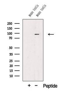 PIWIL1 / PIWI Antibody - Western blot analysis of extracts of mouse testis tissue using PIWL1 antibody. The lane on the left was treated with blocking peptide.