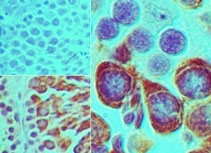 PIWIL2 Antibody - IHC of Mili in formalin-fixed, paraffin-embedded mouse testis tissue using an isotype control (top left) and Peptide-affinity Purified Polyclonal Antibody to Mili (bottom left, right) at 5 ug/ml.