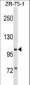 PIWIL2 Antibody - PIWIL2 Antibody western blot of ZR-75-1 cell line lysates (35 ug/lane). The PIWIL2 antibody detected the PIWIL2 protein (arrow).