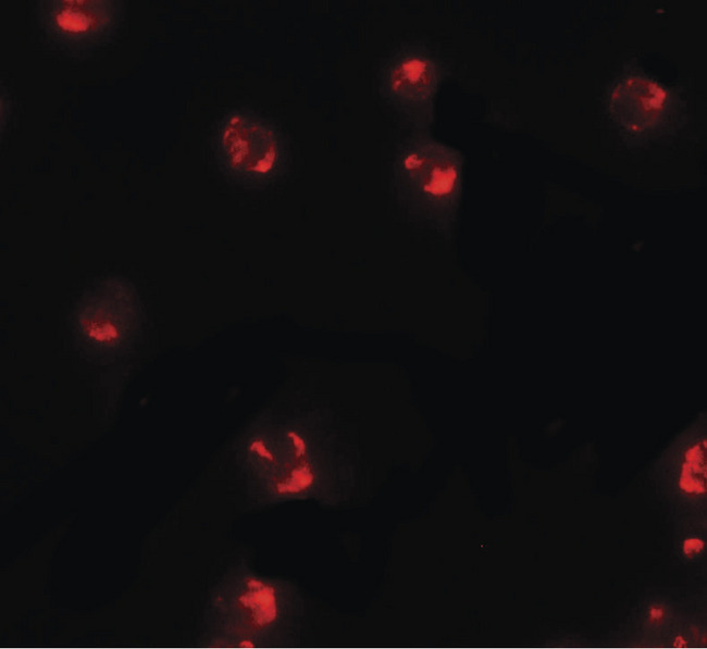 PIWIL2 Antibody - Immunofluorescence of PIWI-L2 in HepG2 cells with PIWI-L2 antibody at 5 ug/ml.