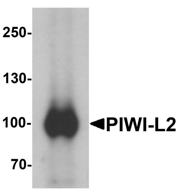 PIWIL2 Antibody - Western blot analysis of PIWI-L2 in HepG2 cell lysate with PIWI-L1 antibody at 1 ug/ml.