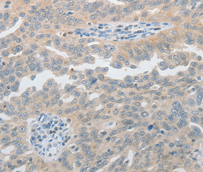 PIWIL2 Antibody - Immunohistochemistry of paraffin-embedded human tonsil tissue.