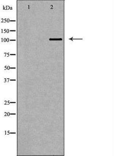 PIWIL2 Antibody - Western blot analysis of extracts of 293T cells using PIWIL2 antibody. The lane on the left is treated with the antigen-specific peptide.