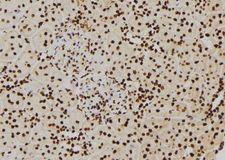 PIWIL2 Antibody - 1:100 staining rat kidney tissue by IHC-P. The sample was formaldehyde fixed and a heat mediated antigen retrieval step in citrate buffer was performed. The sample was then blocked and incubated with the antibody for 1.5 hours at 22°C. An HRP conjugated goat anti-rabbit antibody was used as the secondary.