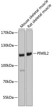 PIWIL2 Antibody - Western blot analysis of extracts of various cell lines using PIWIL2 Polyclonal Antibody at dilution of 1:1000.