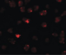 PIWIL3 Antibody - Immunofluorescence of PIWI-L3 in 3T3 cells with PIWI-L3 antibody at 20 ug/ml.