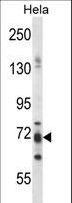 PJA1 / PRAJA1 Antibody - PJA1 Antibody western blot of HeLa cell line lysates (35 ug/lane). The PJA1 antibody detected the PJA1 protein (arrow).