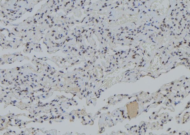PJA1 / PRAJA1 Antibody - 1:100 staining human lung tissue by IHC-P. The sample was formaldehyde fixed and a heat mediated antigen retrieval step in citrate buffer was performed. The sample was then blocked and incubated with the antibody for 1.5 hours at 22°C. An HRP conjugated goat anti-rabbit antibody was used as the secondary.