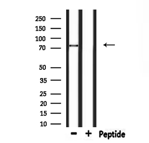 PJA1 / PRAJA1 Antibody - Western blot analysis of extracts of rat brain tissue using PJA1 antibody.