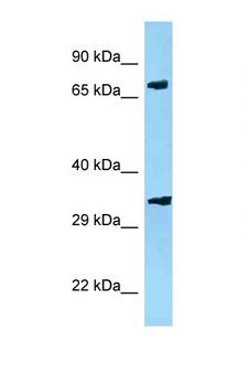 PJA2 Antibody - PJA2 antibody Western blot of Mouse Heart lysate. Antibody concentration 1 ug/ml.  This image was taken for the unconjugated form of this product. Other forms have not been tested.