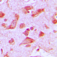 PJA2 Antibody - Immunohistochemical analysis of Praja2 staining in human brain formalin fixed paraffin embedded tissue section. The section was pre-treated using heat mediated antigen retrieval with sodium citrate buffer (pH 6.0). The section was then incubated with the antibody at room temperature and detected using an HRP conjugated compact polymer system. DAB was used as the chromogen. The section was then counterstained with hematoxylin and mounted with DPX.