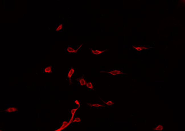 PJA2 Antibody - Staining HeLa cells by IF/ICC. The samples were fixed with PFA and permeabilized in 0.1% Triton X-100, then blocked in 10% serum for 45 min at 25°C. The primary antibody was diluted at 1:200 and incubated with the sample for 1 hour at 37°C. An Alexa Fluor 594 conjugated goat anti-rabbit IgG (H+L) Ab, diluted at 1/600, was used as the secondary antibody.