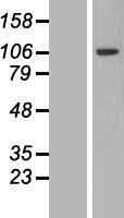 PJA2 Protein - Western validation with an anti-DDK antibody * L: Control HEK293 lysate R: Over-expression lysate