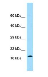 PK2 / PROK2 Antibody - PK2 / PROK2 antibody Western Blot of HT1080.  This image was taken for the unconjugated form of this product. Other forms have not been tested.