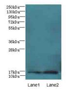 PK2 / PROK2 Antibody - Western blot. All lanes: Prok2 antibody at 3 ug/ml. Lane 1: Mouse gonadal tissue. Lane 2: Mouse small intestine tissue. Secondary Goat polyclonal to Rabbit IgG at 1:10000 dilution. Predicted band size: 14 kDa. Observed band size: 14 kDa.