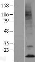 PK2 / PROK2 Protein - Western validation with an anti-DDK antibody * L: Control HEK293 lysate R: Over-expression lysate
