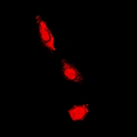 PKC Iota + PKC Zeta Antibody - Immunofluorescent analysis of PKC iota/zeta staining in HeLa cells. Formalin-fixed cells were permeabilized with 0.1% Triton X-100 in TBS for 5-10 minutes and blocked with 3% BSA-PBS for 30 minutes at room temperature. Cells were probed with the primary antibody in 3% BSA-PBS and incubated overnight at 4 deg C in a humidified chamber. Cells were washed with PBST and incubated with a DyLight 594-conjugated secondary antibody (red) in PBS at room temperature in the dark. DAPI was used to stain the cell nuclei (blue).