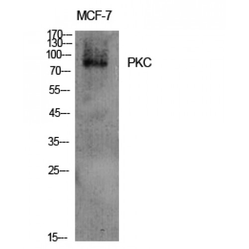 PKC / Protein Kinase C Antibody - Western blot of PKC antibody