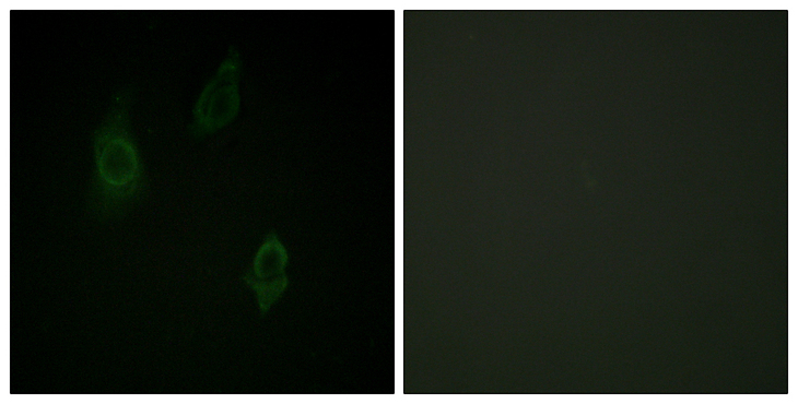 PKC / Protein Kinase C Antibody - Immunofluorescence analysis of HepG2 cells, using PKC-pan (Phospho-Thr497) Antibody. The picture on the right is blocked with the phospho peptide.
