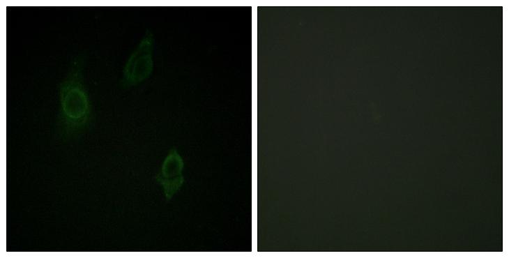 PKC / Protein Kinase C Antibody - P-peptide - + Immunofluorescence analysis of HepG2 cells, using PKC-pan (Phospho-Thr497) antibody.