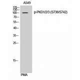 PKD1/2/3 / PKC Mu Antibody - Western blot of Phospho-PKD1/2/3 (S738/S742) antibody