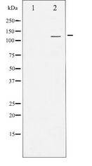 PKD1/2/3 / PKC Mu Antibody - Western blot of PKD1/2/3/PKC mu expression in Jurkat whole cell lysates,The lane on the left is treated with the antigen-specific peptide.