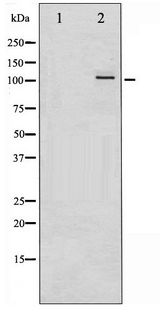PKD1/2/3 / PKC Mu Antibody - Western blot of PKD1/2/3/PKC mu phosphorylation expression in PMA treated A549 whole cell lysates,The lane on the left is treated with the antigen-specific peptide.