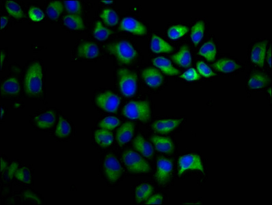 PKD1 / Polycystin Antibody - Immunofluorescence staining of Hela cells diluted at 1:200, counter-stained with DAPI. The cells were fixed in 4% formaldehyde, permeabilized using 0.2% Triton X-100 and blocked in 10% normal Goat Serum. The cells were then incubated with the antibody overnight at 4°C.The Secondary antibody was Alexa Fluor 488-congugated AffiniPure Goat Anti-Rabbit IgG (H+L).