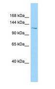 PKD1L1 Antibody - PKD1L1 antibody Western Blot of NCI-H226.  This image was taken for the unconjugated form of this product. Other forms have not been tested.