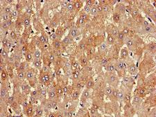 PKD1L1 Antibody - Immunohistochemistry image of paraffin-embedded human liver tissue at a dilution of 1:100