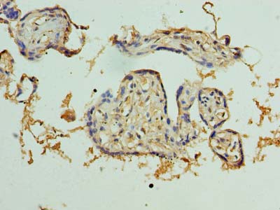 PKD1L2 Antibody - Immunohistochemistry of paraffin-embedded human placenta tissue using antibody at dilution of 1:100.