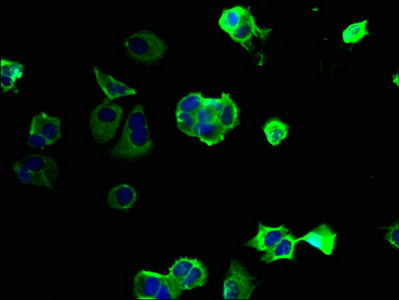 PKD1L2 Antibody - Immunofluorescent analysis of MCF-7 cells using PKD1L2 Antibody at dilution of 1:100 and Alexa Fluor 488-congugated AffiniPure Goat Anti-Rabbit IgG(H+L)