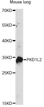 PKD1L2 Antibody - Western blot analysis of extracts of mouse lung, using PKD1L2 antibody at 1:1000 dilution. The secondary antibody used was an HRP Goat Anti-Rabbit IgG (H+L) at 1:10000 dilution. Lysates were loaded 25ug per lane and 3% nonfat dry milk in TBST was used for blocking. An ECL Kit was used for detection and the exposure time was 30s.