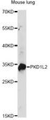 PKD1L2 Antibody - Western blot analysis of extracts of mouse lung, using PKD1L2 antibody at 1:1000 dilution. The secondary antibody used was an HRP Goat Anti-Rabbit IgG (H+L) at 1:10000 dilution. Lysates were loaded 25ug per lane and 3% nonfat dry milk in TBST was used for blocking. An ECL Kit was used for detection and the exposure time was 30s.