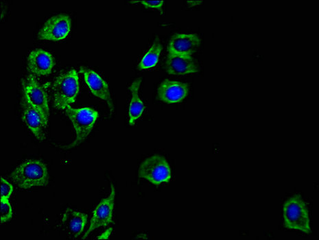PKD1L3 Antibody - Immunofluorescent analysis of A549 cells using PKD1L3 Antibody at a dilution of 1:100 and Alexa Fluor 488-congugated AffiniPure Goat Anti-Rabbit IgG(H+L)