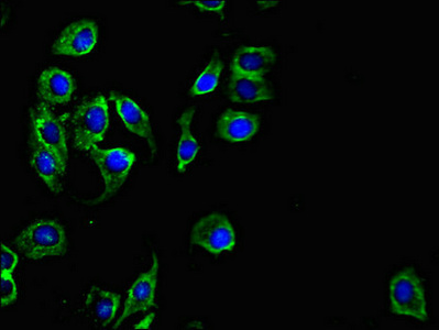 PKD1L3 Antibody - Immunofluorescent analysis of A549 cells using PKD1L3 Antibody at dilution of 1:100 and Alexa Fluor 488-congugated AffiniPure Goat Anti-Rabbit IgG(H+L)